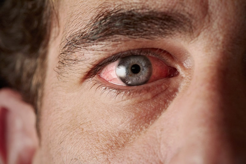Dry Eye's Hidden Cause: Your Cellular Cleanup System