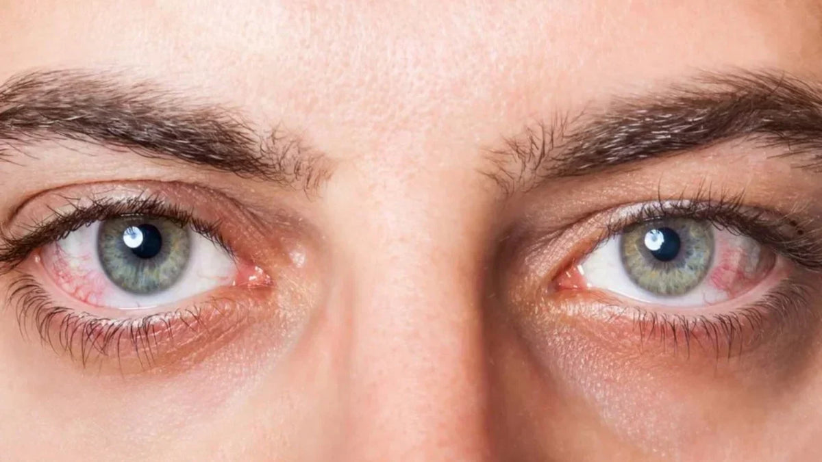Natural Ways to Support Healthy Eye Pressure