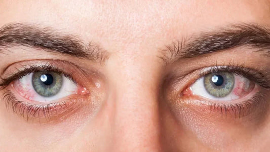Eyes